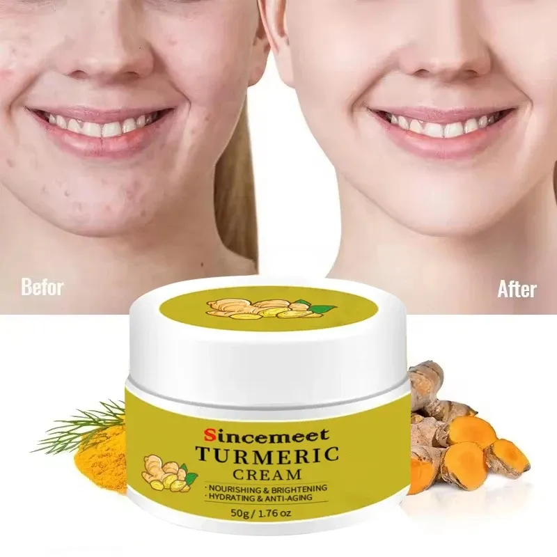 OEM Face Cream Care Removing Dark Spots Acne Treatment Anti Acne Face Vitamin C Cream Turmeric Cream