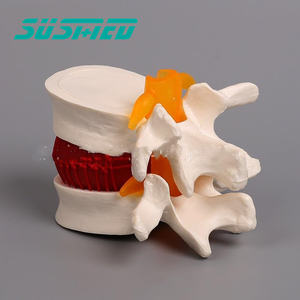 Modèle de démonstration de hernie discale lombaire humaine modèle d'enseignement de l'anatomie de la pathologie discale - Product Image 6