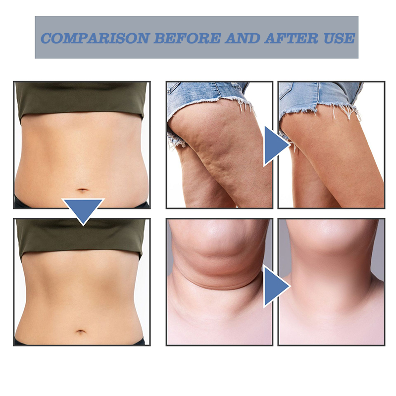 hot selling super slim slimming & detoxifying nose essential oil ring