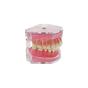 Modelo Dental Transparente con Raíz Dental Visible, Modelo de Tipodonto Dental con Dientes Extraíbles, Encías Suaves, Modelos de Práctica de Extracción Dental - Product Image 2