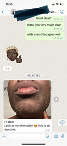 Salon Custom ized/Private Logo Verfügbar Spong illa Spicules Haut Peeling Akne Pigmentierung Massage Verwenden Sie natürliche nicht chemische Säure - Product Image 6