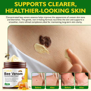 ELAIMEI <strong>Removes</strong> All Skin <strong>Warts</strong> Bee Venom <strong>Cream</strong> Skin Spot Smooths the Look of Fine Lines Skin Tag <strong>Removal</strong> Bee Venom <strong>Cream</strong> - Product Image 3