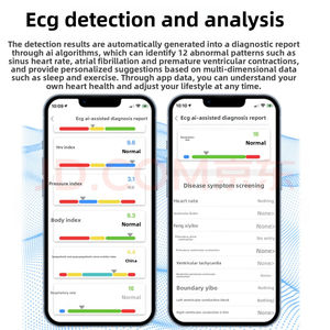 Anel Inteligente de ECG de Grau Médico Novo para Análise de Frequência Cardíaca e Oxigênio no Sangue com Detecção de IA Metal IP67 - Product Image 4