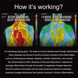 Nối đất cho giường thảm nối đất tốt nhất cho nối đất giường nữ hoàng nối đất trị liệu nối đất Mat tấm nối đất - Product Image 2