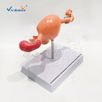 Modèle pathologique de maladie utérine grandeur nature en PVC avec endométriose et fibromes pour l'enseignement médical CE ISO ROHS CNAS