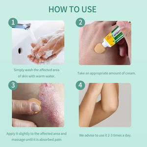 Crème Dermatite à Base de Plantes Chinoises Personnalisable en Usine pour Eczéma Cutané Démangeaisons Psoriasis Antiprurigineuse - Product Image 5