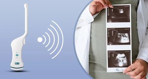 Mesin pemindai <span class=keywords><strong>Ultrasound</strong></span> Doppler warna nirkabel, pemindai vagina mikro-cembung <span class=keywords><strong>128</strong></span> elemen cembung - Product Image 5
