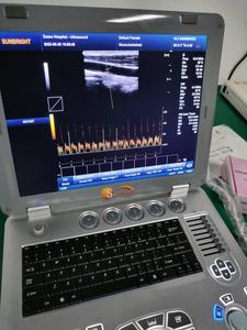 Sistem Ultrasound Veteriner B/W Berkualitas Tinggi dan Murah, Perangkat Ultrasound <span class=keywords><strong>Doppler</strong></span> - Product Image 3
