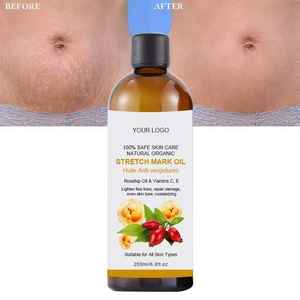 Crema Orgánica Potente para Estrías OEM/ODM, Aceite Esencial Efectivo para Masaje Corporal, para la Recuperación y Eliminación <span class=keywords><strong>de</strong></span> la Piel - Product Image 1