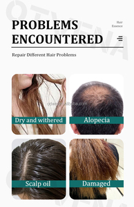 OTVENA สเปรย์บำรุงเส้นผม ป้องกันผมร่วงและเพิ่มความชุ่มชื้น ช่วยเร่งการเจริญเติบโตของเส้นผม - Product Image 6