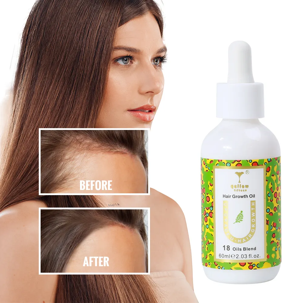 Revitalisieren Sie Ihre Locken mit luxuriösen mit Vitamin E und Biotin inspirierten Eigenmarken Haarwachstumsöl