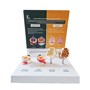 Pabrik langsung sekolah pengajaran manusia model anatomi kronis paru menghalangi Penyakit Paru - Product Image 1