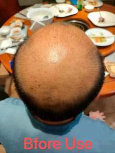 Vente en gros d'huile à base de plantes favorisant la croissance des cheveux Anti-chute Répare les cheveux abîmés Sérum hydratant pour le cuir chevelu Shampooing et après-shampoing - Product Image 3