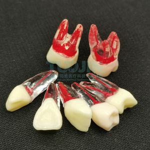 Educatieve Leverancier Tandheelkundige Endo Tanden Wortelpraktijk Tand Dentale Endodontische Tand <span class=keywords><strong>Model</strong></span> Met Gekleurde Wortel En Pulp - Product Image 3