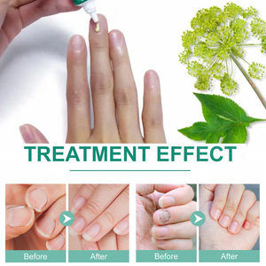 Vente en gros Ximonth Herbal Traitement de la décoloration Crème de soin des ongles Réparation des fissures Crème antifongique - Product Image 4