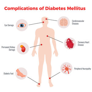 Krim perawatan kesehatan tubuh Herbal untuk perawatan kaki Diabet - Product Image 2