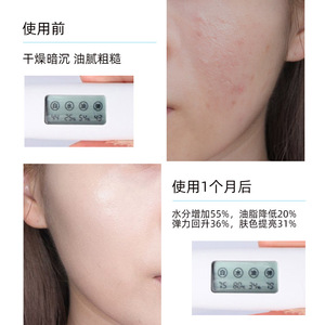 Set Rejuvenecedor Antiarrugas con Ergotioneína Moika, Kit de Cuidado Facial de 7 Piezas para Todo Tipo de Piel - Product Image 1