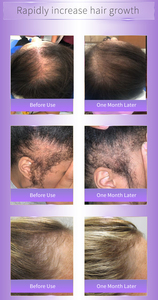 Bienvenido al aceite de argán de marca privada, tratamiento de aceite para el cabello de la marca arganrro - Product Image 5