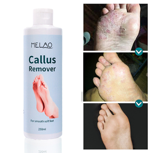 Exfoliante de Marca Privada, Gel Hidratante, Lima de Pies Colosal, Removedor de <span class=keywords><strong>Callos</strong></span>, <span class=keywords><strong>Crema</strong></span> Exfoliante <span class=keywords><strong>para</strong></span> Pies con Talones Agrietados - Product Image 5