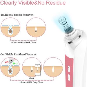 เครื่องดูดสิวเสี้ยนไฟฟ้า พร้อมกล้อง HD ขยายภาพ 20 เท่า หัวดูด 6 แบบ - Product Image 3