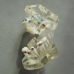 Dents dentaires orth modèles orthodontiques avec supports - Product Image 5