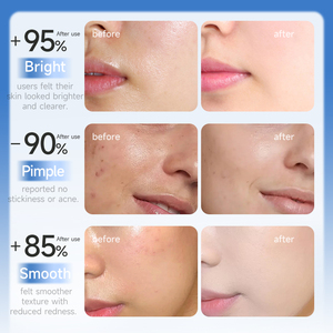 <span class=keywords><strong>Crema</strong></span> <span class=keywords><strong>Solare</strong></span> <span class=keywords><strong>Viso</strong></span> Premium SPF50 Plus Schiarente e Illuminante Protezione UV Antiage <span class=keywords><strong>Idratante</strong></span> Leggera - Product Image 3