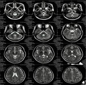 Hastaneler/Klinikler ve PET Kullanımı için Sıcak Satış A3/A4/A5 Beyaz Lazer Tıbbi Röntgen Filmi - Product Image 2