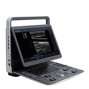 Ecógrafo Veterinario E1V 3D/2D Blanco y Negro Portátil con Pantalla de 15.6 Pulgadas, Transductor Lineal Endocavitario L741V USB E1V Sonoscap - Product Image 1