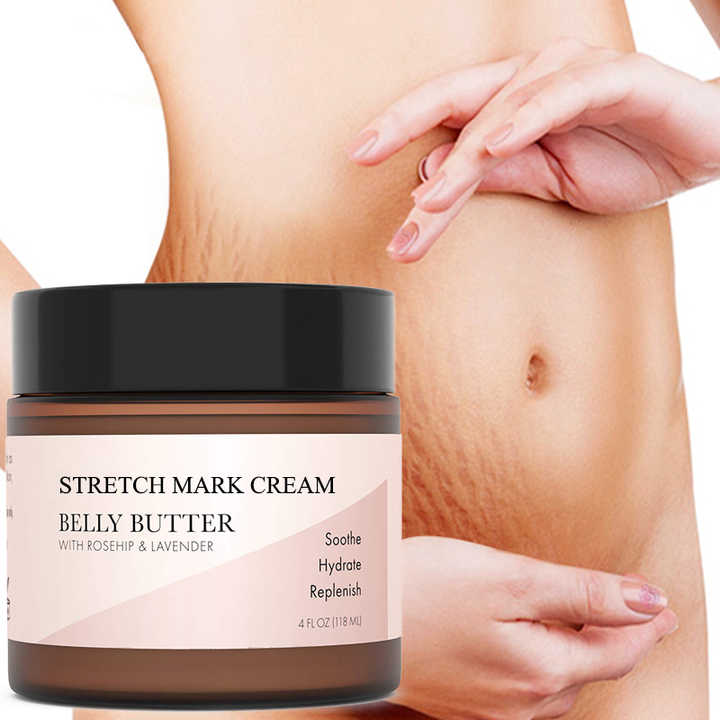 Wholesale Private Label 100% Natural Maternity Skin Care Anti Stretch Marks Removal Cream