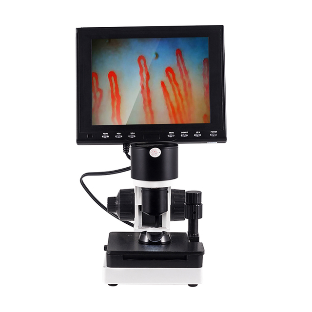 Wholesale Y-Rising YR-880 Portable Blood Capillary Microscope 8-Inch LED Display 380000-Pixel Camera CE Certified Fold Video
