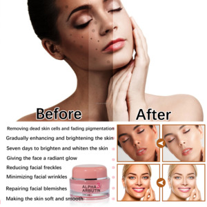 Crema Viso OEM con Vitamina E e Arancia per Schiarire la Pelle, Rimuovere le Macchie e le Cicatrici, Prodotti per la Cura del Viso - Product Image 3