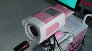 Colposcopio Óptico Digital Electrónico / Colposcopio con Cámara para Detección Temprana de Lesiones - Product Image 6