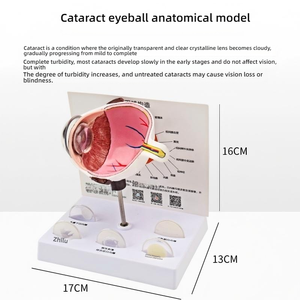 Modelo Anatómico <span class=keywords><strong>del</strong></span> <span class=keywords><strong>Ojo</strong></span> Humano Ampliado con 5 Tipos de Lentes Patológicas de Catarata para la Enseñanza de Oftalmología - Product Image 5