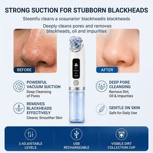 Removedor de Puntos Negros Eléctrico Z, Limpiador Facial con Succión al Vacío, Rejuvenecimiento de la Piel, 6 Cabezales de Succión - Product Image 3