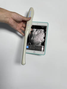 Transvaginale Array <span class=keywords><strong>Endocavity</strong></span> Ultrasone Draadloze Ultrasound <span class=keywords><strong>Probe</strong></span> - Product Image 4