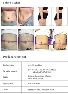 Appareil anti-âge 7D de bureau à 7 cartouches pour l'élimination des rides du visage, le lifting du cou et l'amincissement corporel pour cliniques et spas - Product Image 6