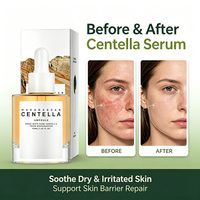 Sérum Ampoule à la Centella Anti-rides, Niacinamide Hydratant, Apaisant, Réparateur, Réducteur de Pores, Usage Domestique, pH 5.5, Doux pour Peaux Sensibles