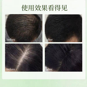 <span class=keywords><strong>Savon</strong></span> Solide Artisanal aux Huiles Essentielles Pures, Parfum Herbal Cèdre et Osmanthus, Soin Capillaire et Nettoyant Visage aux Herbes - Product Image 6