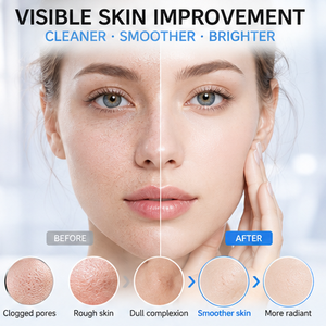 Masseur facial blanc, appareil de soin de la peau pour un nettoyage en profondeur, nettoyeur de pores, éliminateur de résidus de maquillage, outil de nettoyage du visage - Product Image 4
