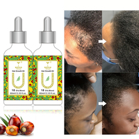 Private Label Bio-Haarserum-Öl mit Squalan für Haarwachstum Alkoholfrei & Sulfatfrei für Männer & Frauen