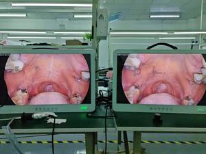 Y tế cấp xách tay nội soi máy ảnh cho nội soi nội soi Ent hysteroscopy tiết niệu thủ tục - Product Image 5