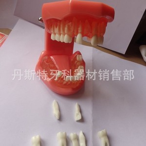 Modèle d'extraction dentaire Dt 7-1, modèle anatomique en silicone médical pour l'enseignement dentaire - Product Image 1