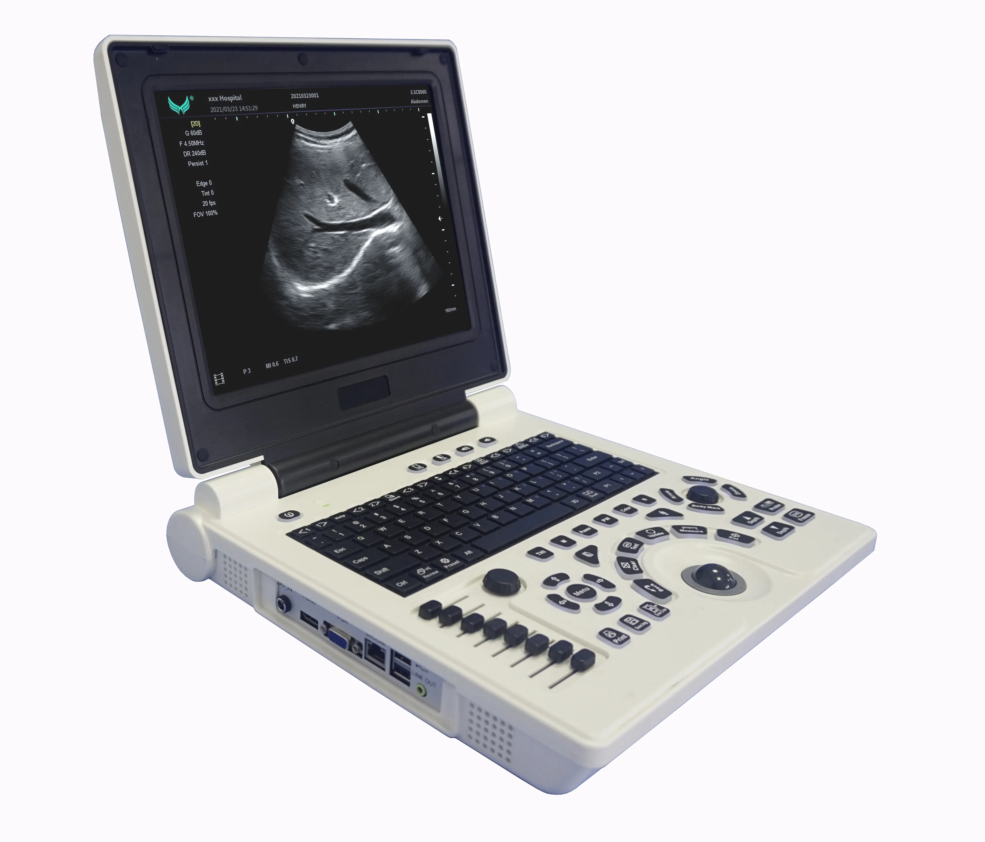 Echo medical laptop 3d ultrasound machine portable B/W ultrasound system wireless ultrasound