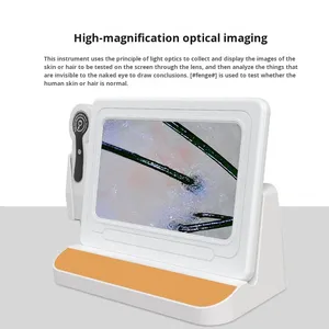 Detector de Cuero Cabelludo Botin, Analizador de Folículos Pilosos, Analizador de Piel, Dispositivo de Fotocaptura, Terapia Capilar, Uso en Salón de Belleza, 1 Año, 220V, IP67 - Product Image 2