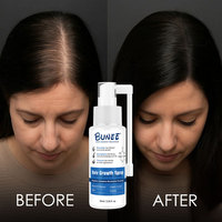 Traitement Capillaire Croissance Rapide Spray Anti-Chute Soin Cheveux Biotine Eau de Riz Noir Sérum Croissance Cheveux pour Hommes et Femmes 60ml