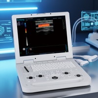 Système d'échographie Doppler couleur vétérinaire portable haute résolution 3D avec écran LCD de 15 pouces pour diagnostic médical