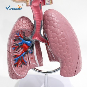 Modelo del Sistema Respiratorio para el Estudio del Asma: Comparación Visual de Bronquios Sanos y Vías Respiratorias Contraídas por Asma para la Enseñanza de Pulmonología - Product Image 5