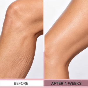 Crème raffermissante pour le corps douce et efficace, rétablit l'élasticité, élimine les rides, lisse la peau en 4 semaines, convient à tous les types de peau. - Product Image 3