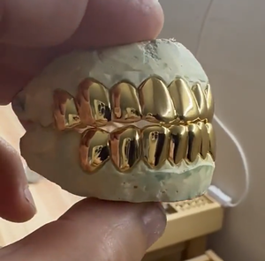Grilles dentaires personnalisées en or plaqué 10k 14k 18k et argent sterling 925, style hip-hop rock, avec pierres incrustées, coupe permanente - Product Image 2