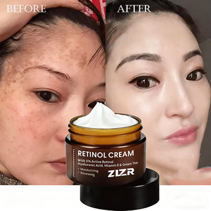 Crème anti-taches de haute qualité, anti-rides, éclaircissante, blanchissante, au collagène, au rétinol et à la vitamine C pour le visage - Product Image 1